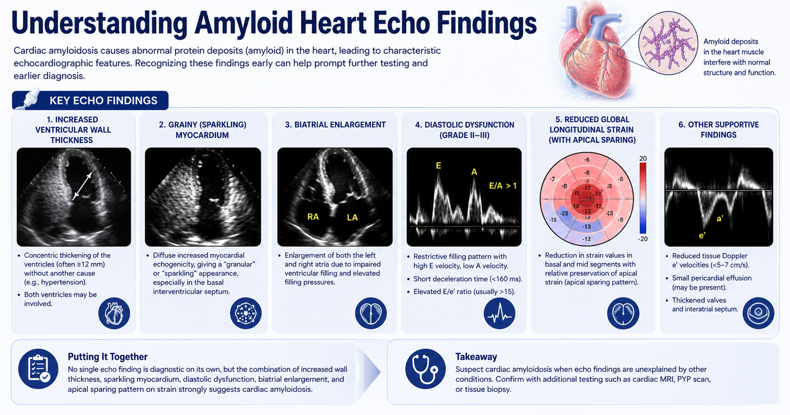 Understanding Amyloid Heart Echo Findings