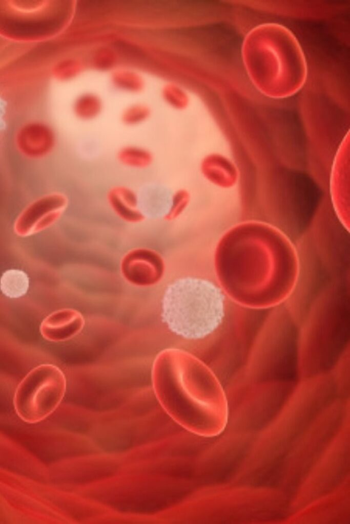 Cancer Disease: Types, Causes, and Modern Treatments Leukemias 683x1024