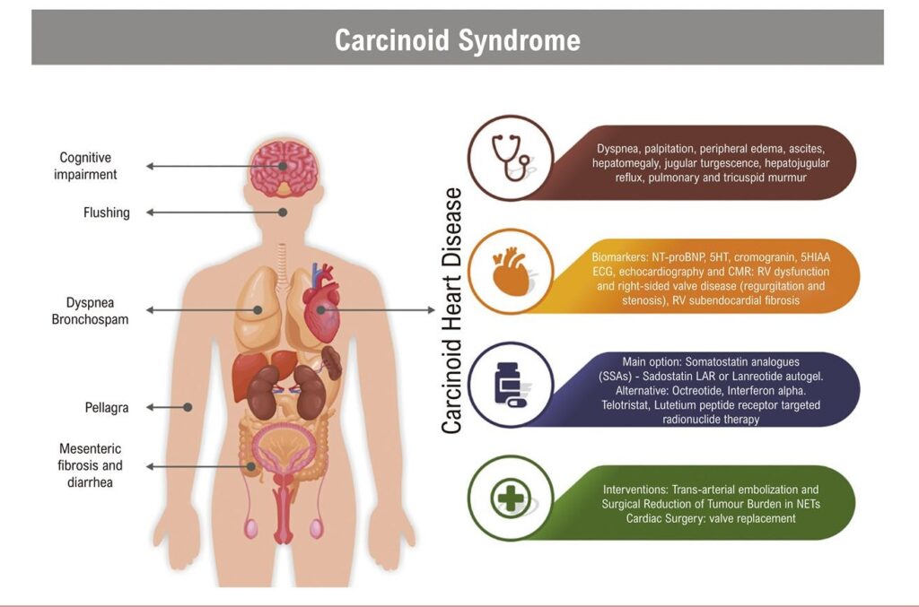 Caecinoid 1 1024x677