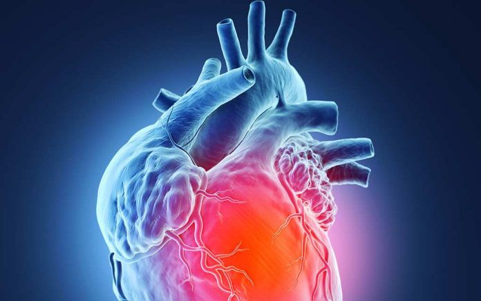 carcinoid heart disease